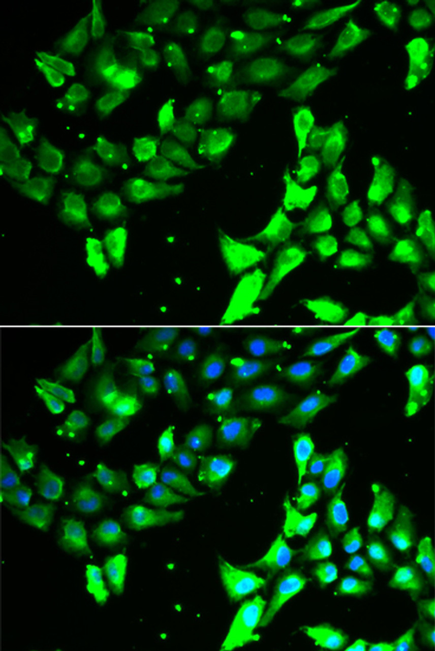 Immunofluorescence analysis of A549 cells using KIF2B Polyclonal Antibody