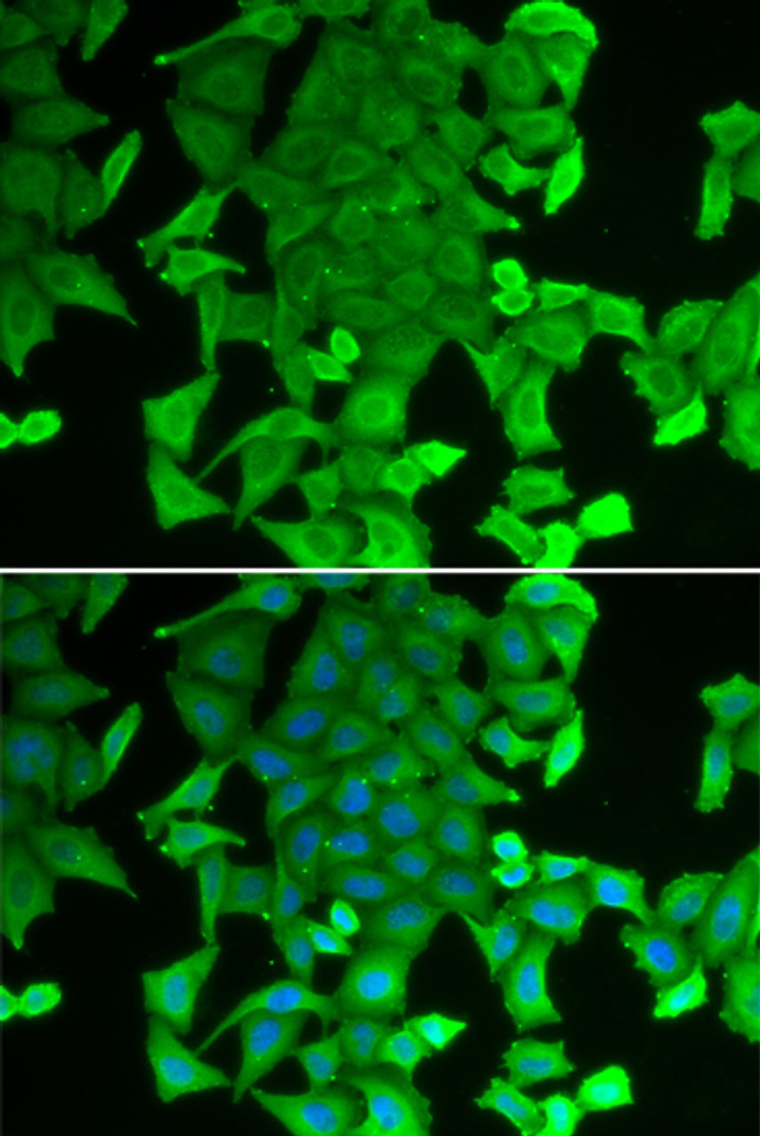 Immunofluorescence analysis of MCF-7 cells using RFFL Polyclonal Antibody