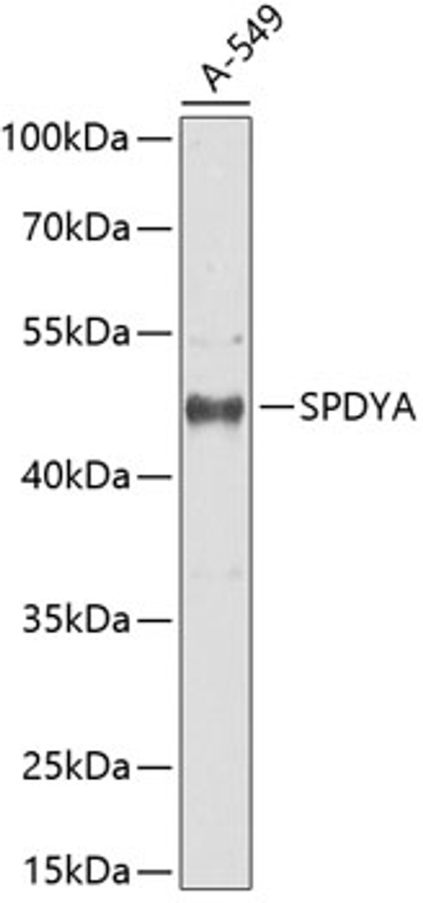Western blot analysis of extracts of A549 cells using SPDYA Polyclonal Antibody at dilution of 1:1000.