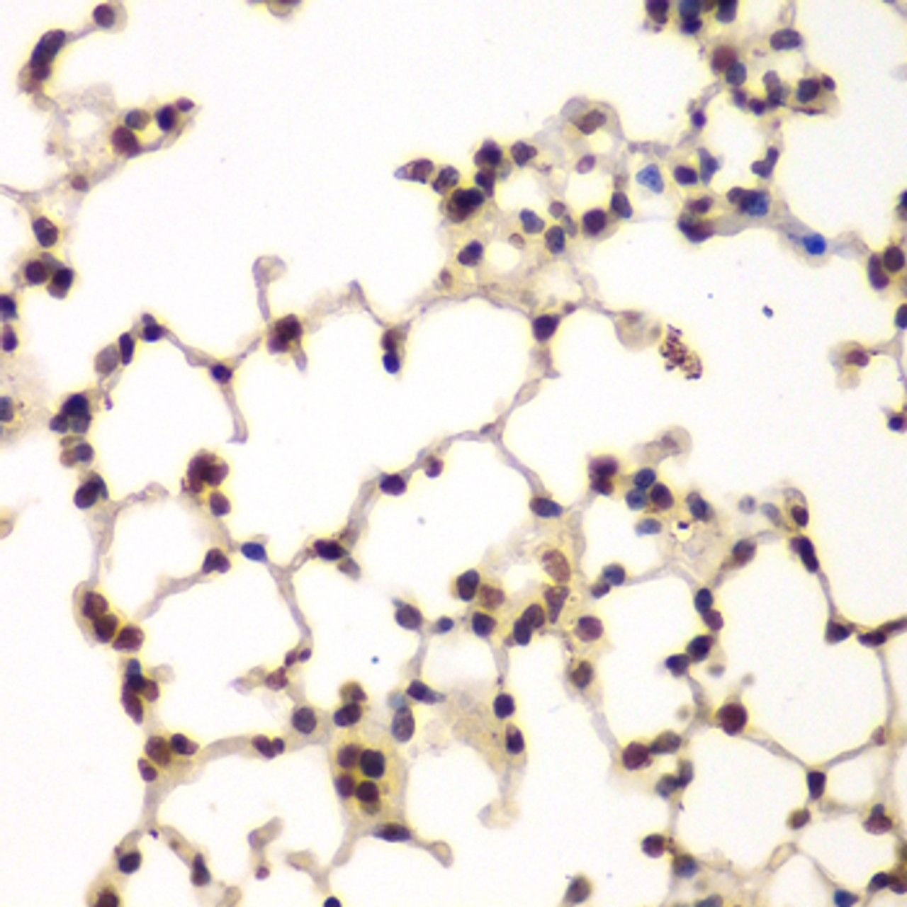 Immunohistochemistry of paraffin-embedded Mouse lung using PRKCB Polyclonal Antibody at dilution of  1:200 (40x lens).