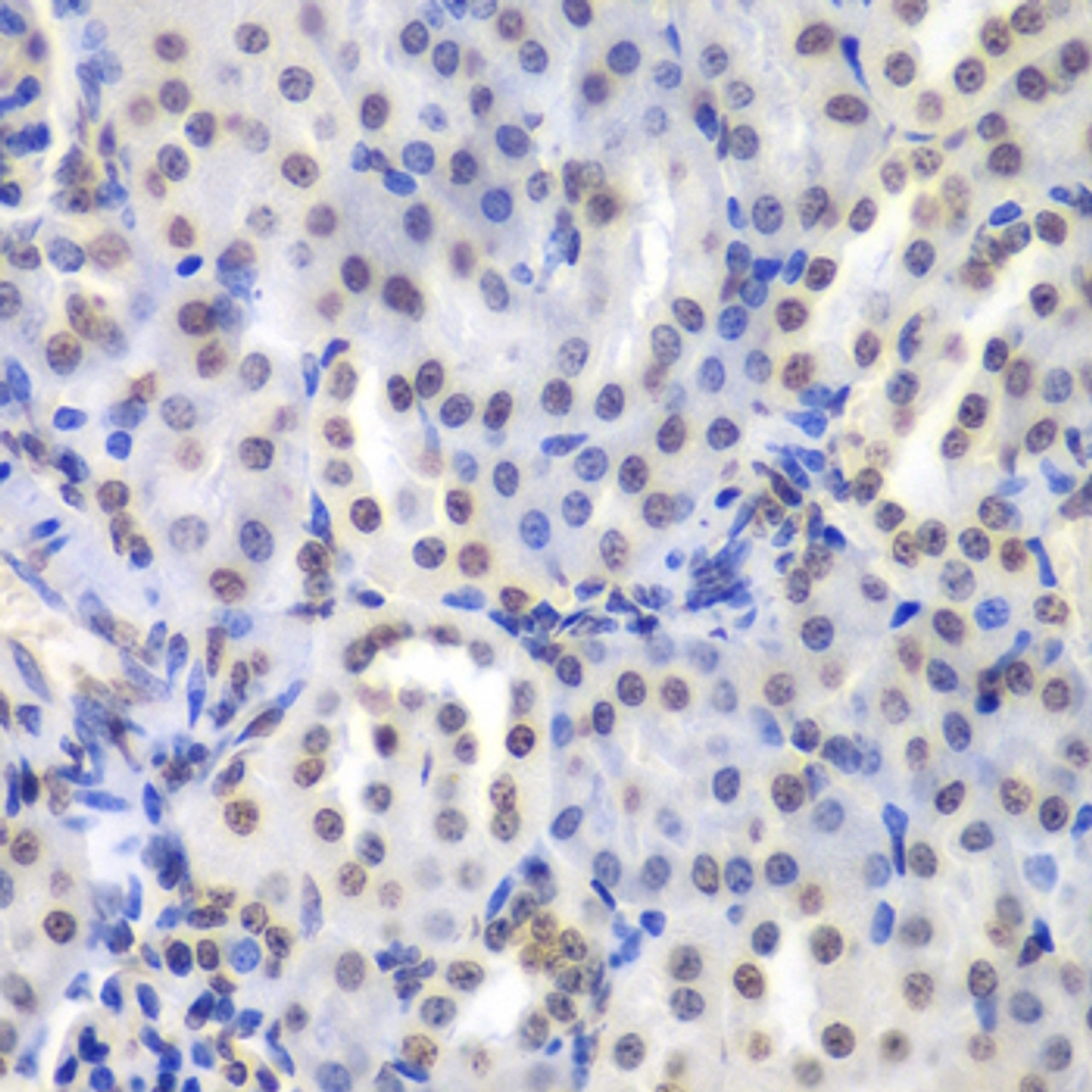 Immunohistochemistry of paraffin-embedded Mouse kidney using PRKCB Polyclonal Antibody at dilution of  1:200 (40x lens).