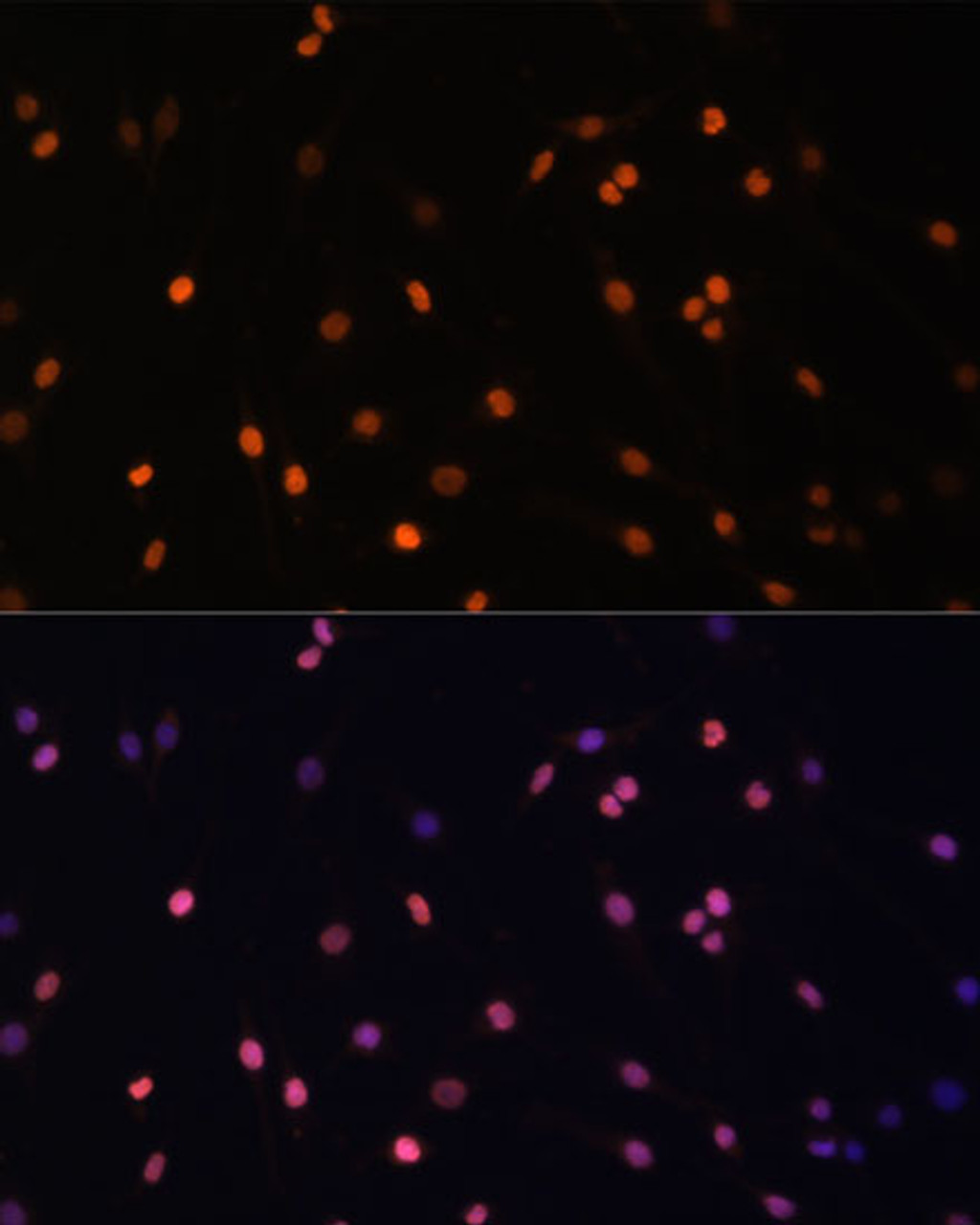 Immunofluorescence analysis of C6 cells using PRKCB Polyclonal Antibody at dilution of  1:100 (40x lens). Blue: DAPI for nuclear staining.