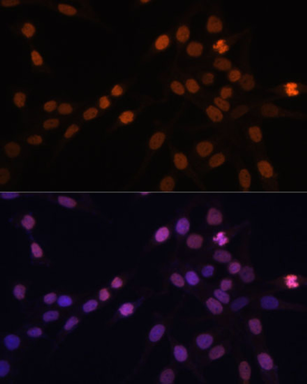 Immunofluorescence analysis of HeLa cells using PRKCB Polyclonal Antibody at dilution of  1:100 (40x lens). Blue: DAPI for nuclear staining.