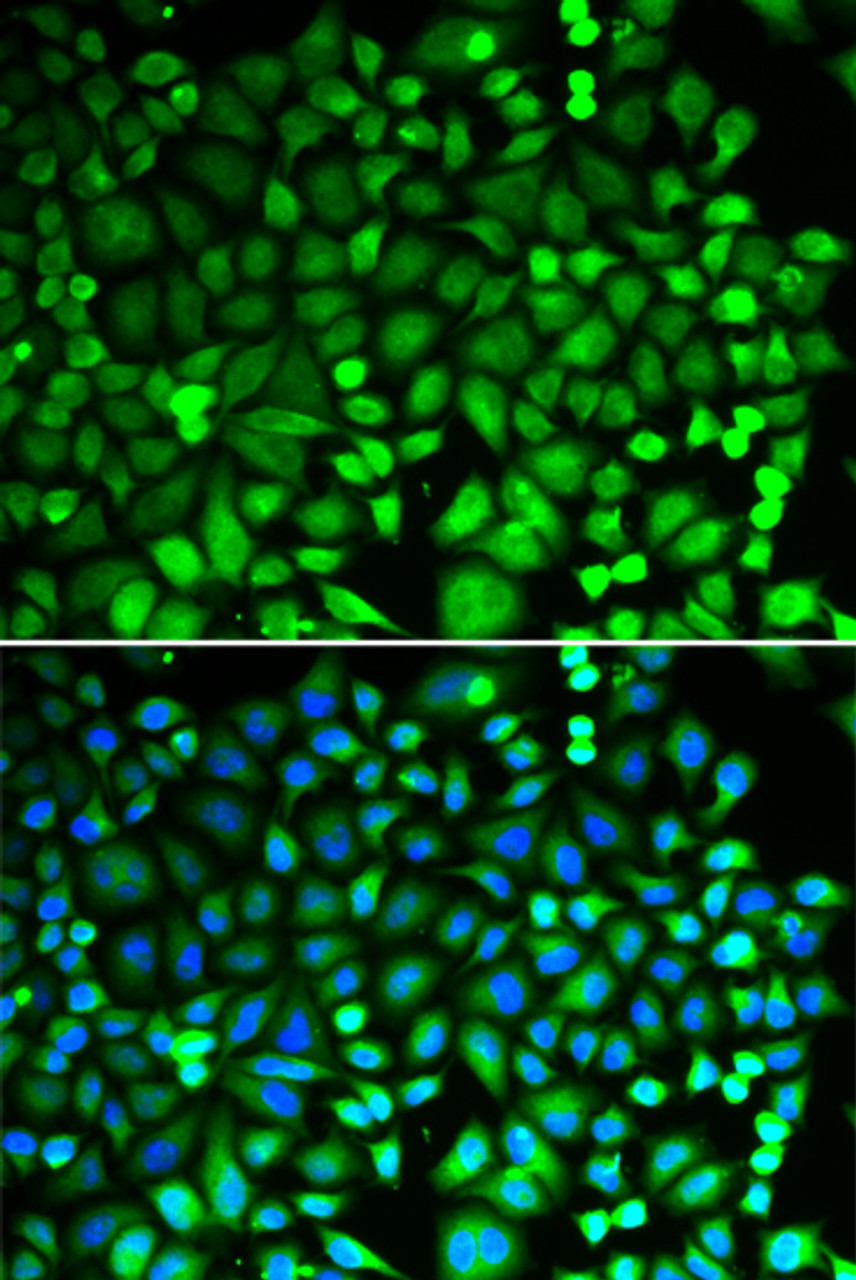 Immunofluorescence analysis of MCF-7 cells using PSMB2 Polyclonal Antibody