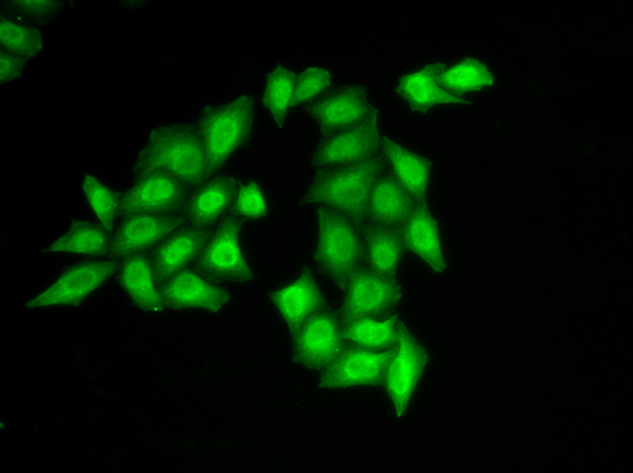 Immunofluorescence analysis of HeLa cells using SSRP1 Polyclonal Antibody