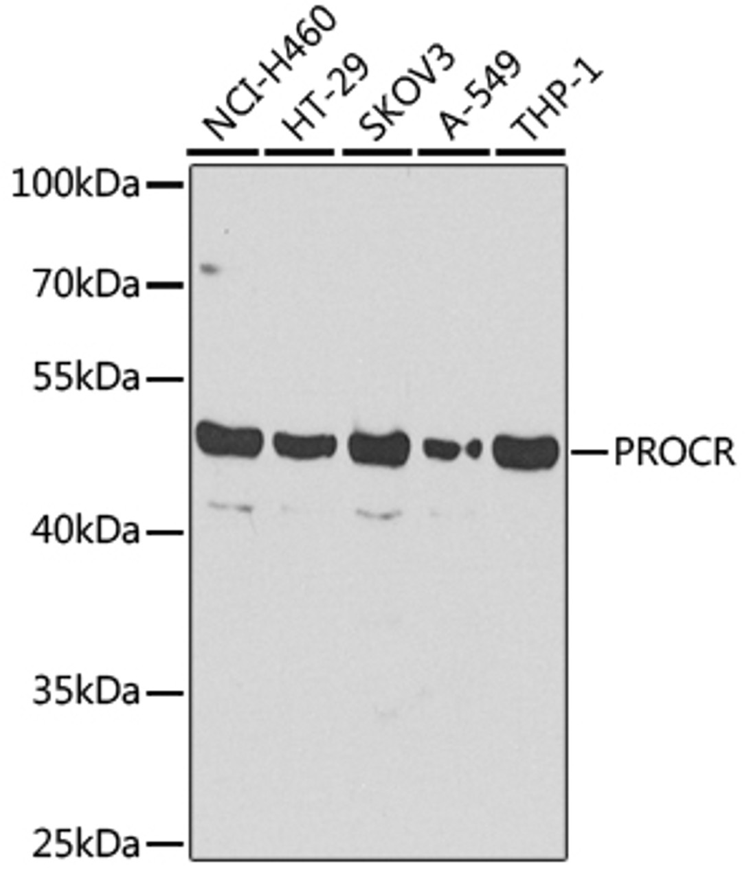 Western blot analysis of extracts of various cell lines using PROCR Polyclonal Antibody at dilution of 1:1000.