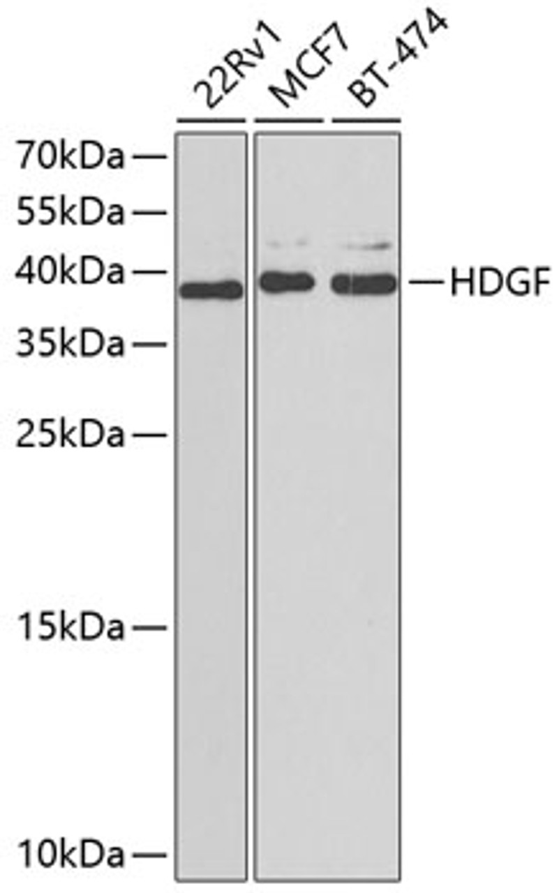 Western blot analysis of extracts of various cell lines using HDGF Polyclonal Antibody at dilution of 1:1000.