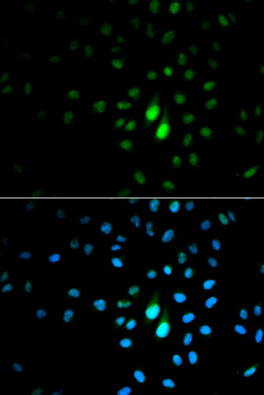 Immunofluorescence analysis of MCF-7 cells using PIN1 Polyclonal Antibody