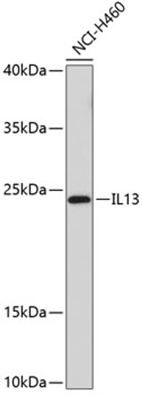 Western blot analysis of extracts of NCI-H460 cells using IL13 Polyclonal Antibody.