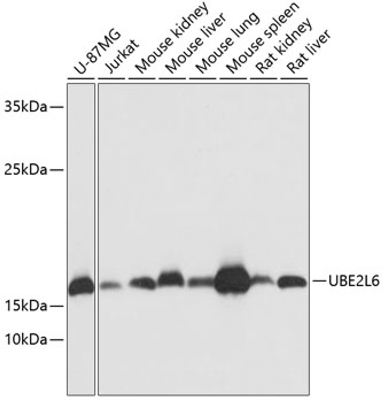 Western blot analysis of extracts of various cell lines using UBE2L6 Polyclonal Antibody at dilution of 1:1000.