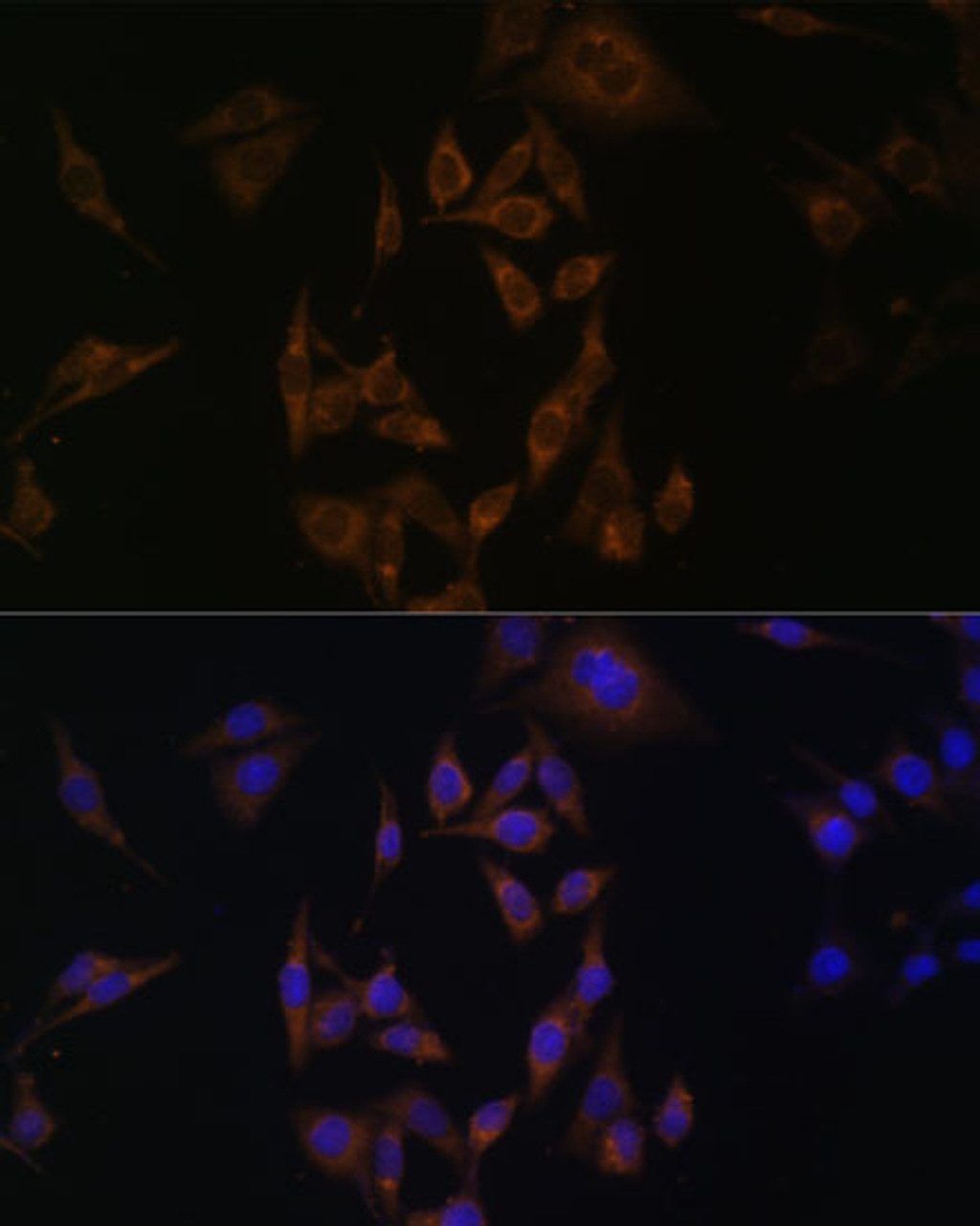 Immunofluorescence analysis of HeLa cells using UBE2L6 Polyclonal Antibody at dilution of  1:100. Blue: DAPI for nuclear staining.