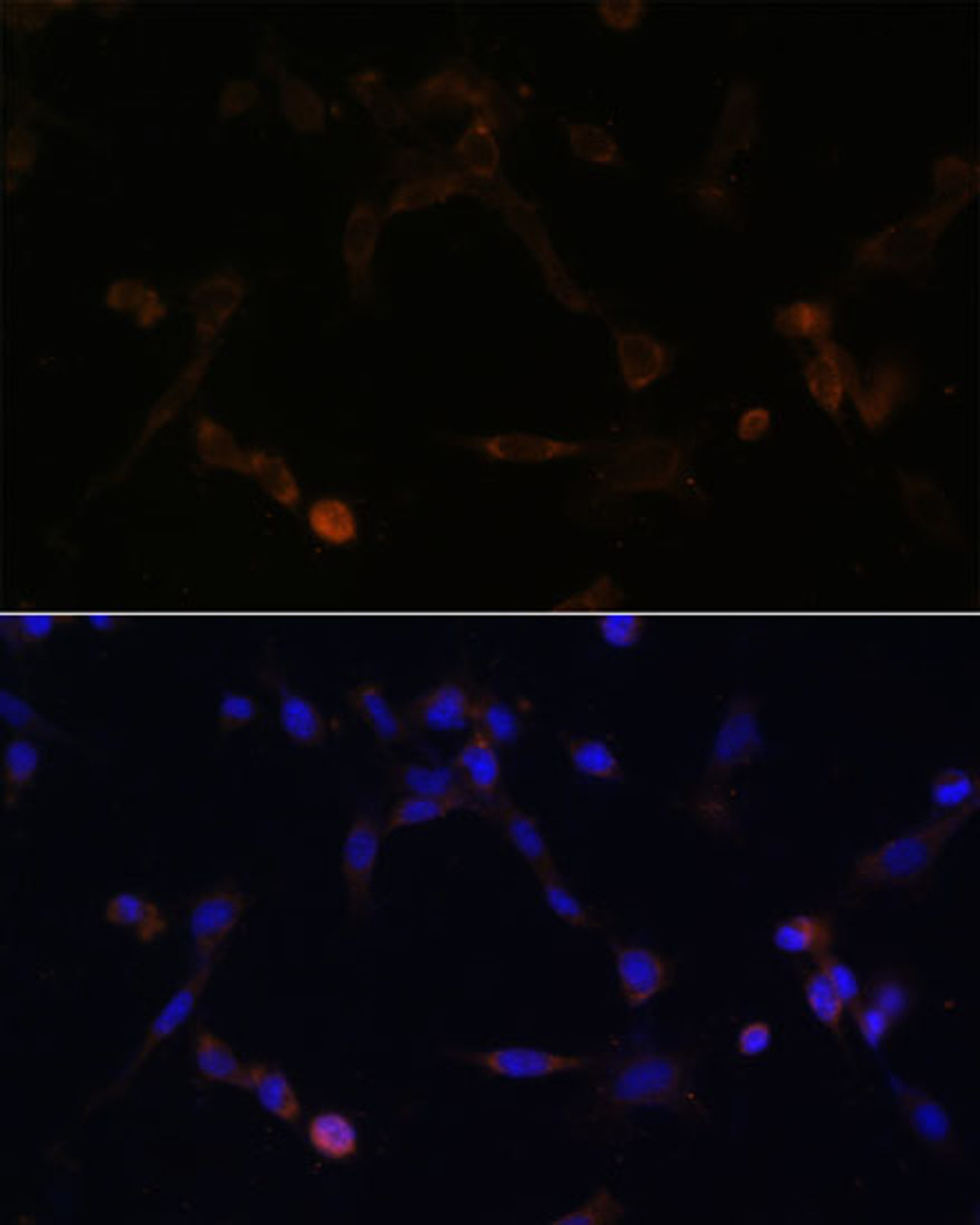 Immunofluorescence analysis of NIH/3T3 cells using UBE2L6 Polyclonal Antibody at dilution of  1:100. Blue: DAPI for nuclear staining.