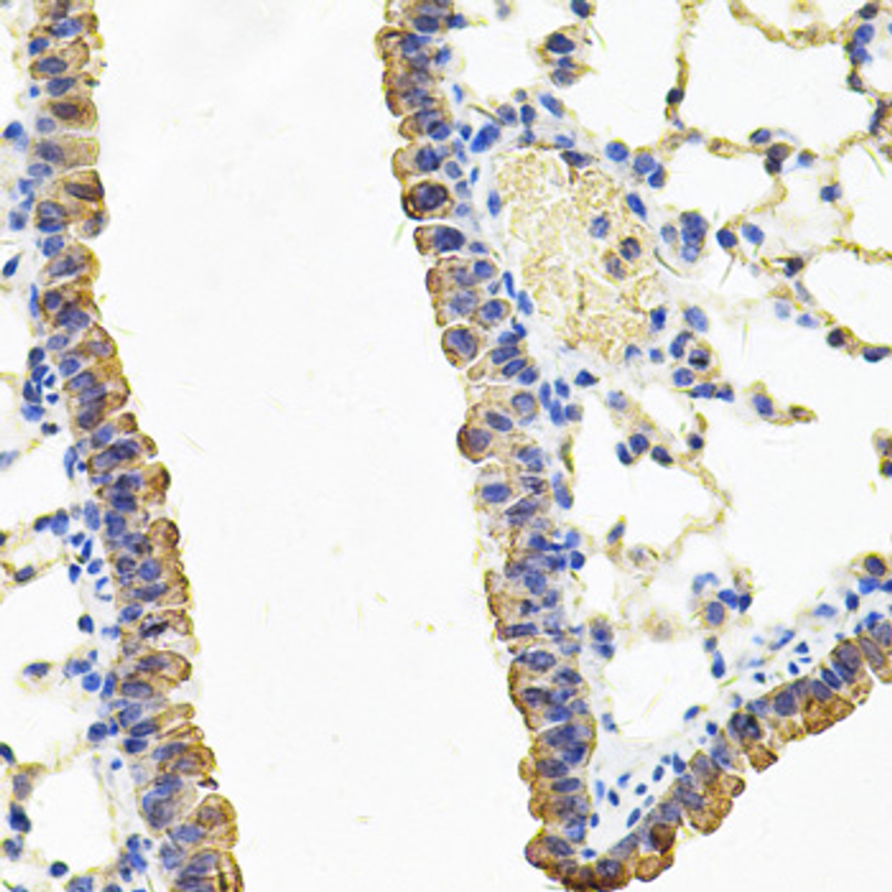 Immunohistochemistry of paraffin-embedded Mouse lung using CARS Polyclonal Antibody at dilution of  1:100 (40x lens).