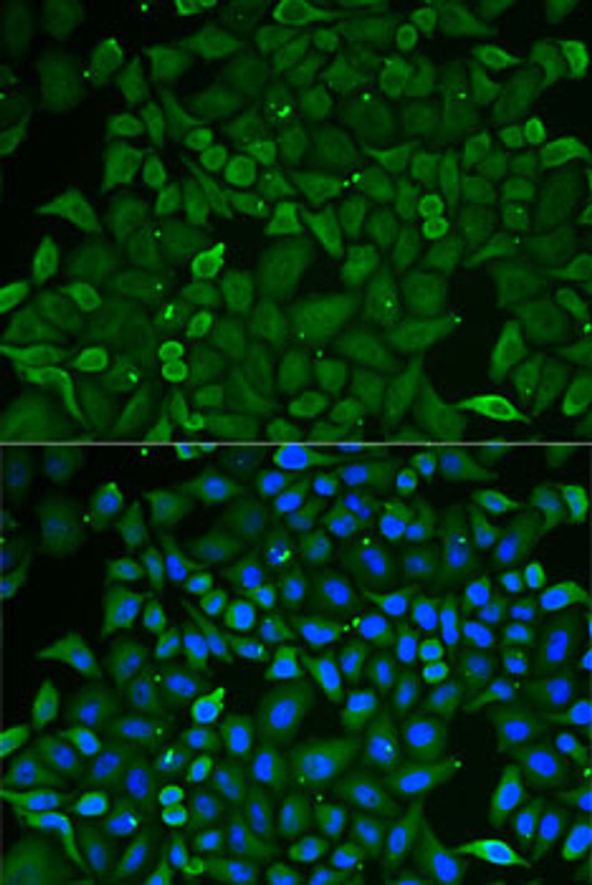 Immunofluorescence analysis of U2OS cells using CARS Polyclonal Antibody