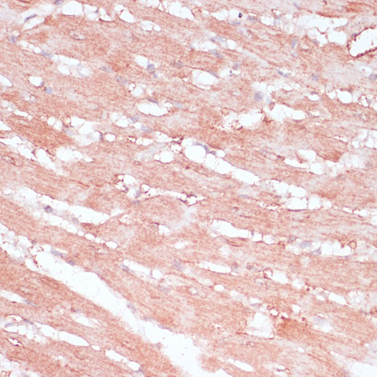 Immunohistochemistry of paraffin-embedded Rat heart using RPL30 Polyclonal Antibody at dilution of  1:100 (40x lens).
