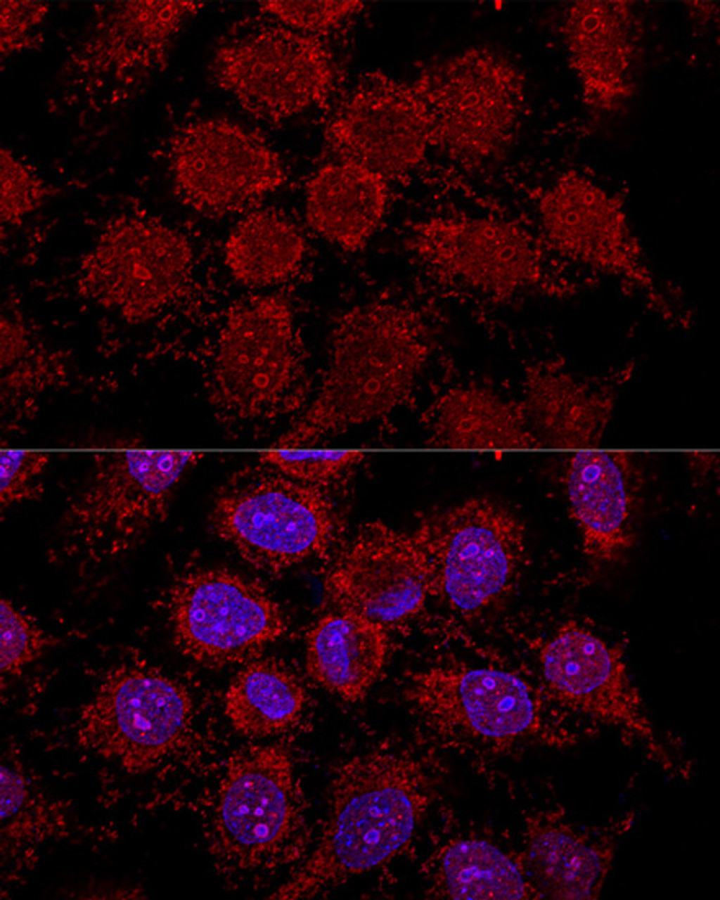 Confocal immunofluorescence analysis of HeLa cells using RPL30 Polyclonal Antibody at dilution of  1:200. Blue: DAPI for nuclear staining.