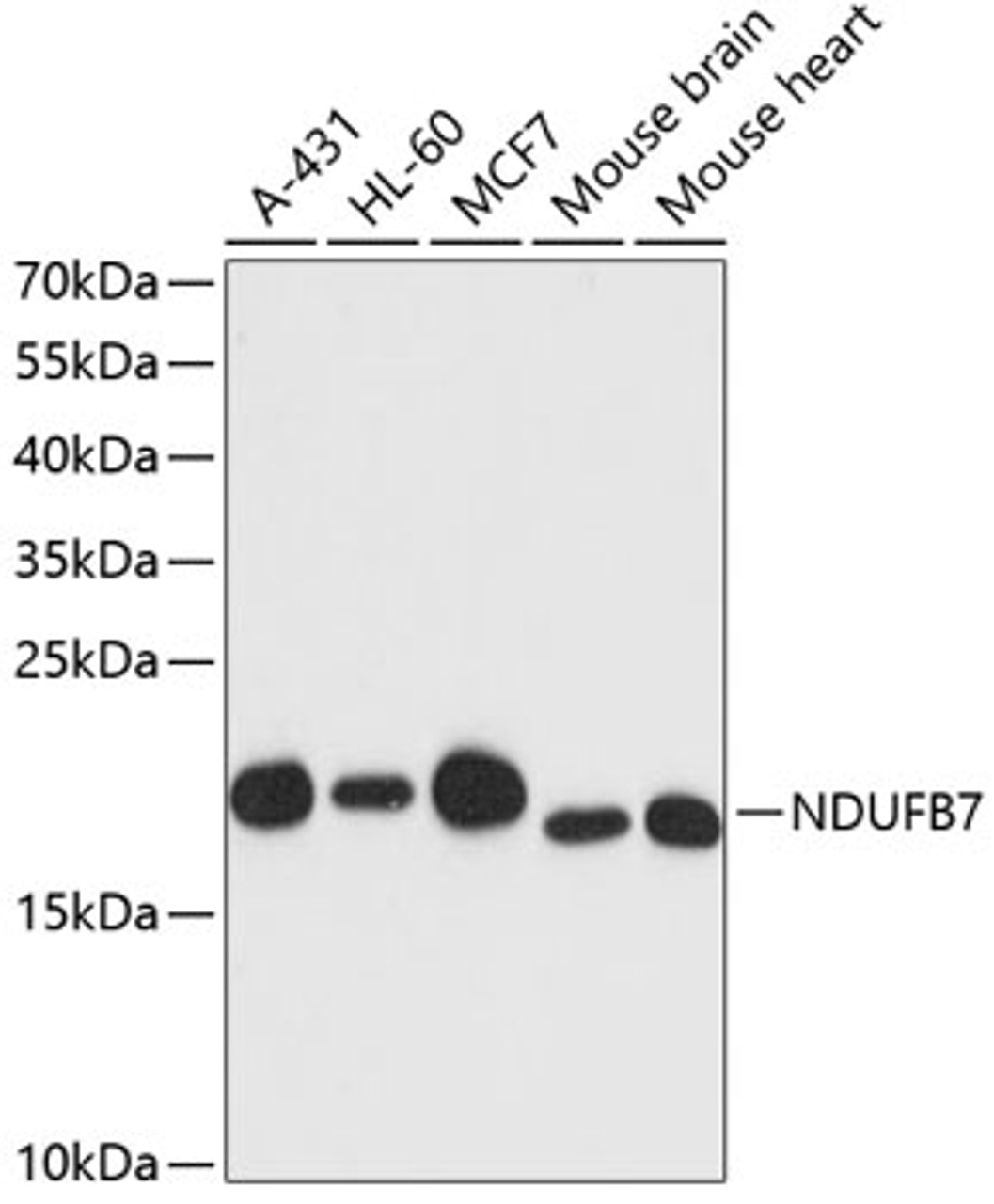 Western blot analysis of extracts of various cell lines using NDUFB7 Polyclonal Antibody at dilution of 1:3000.