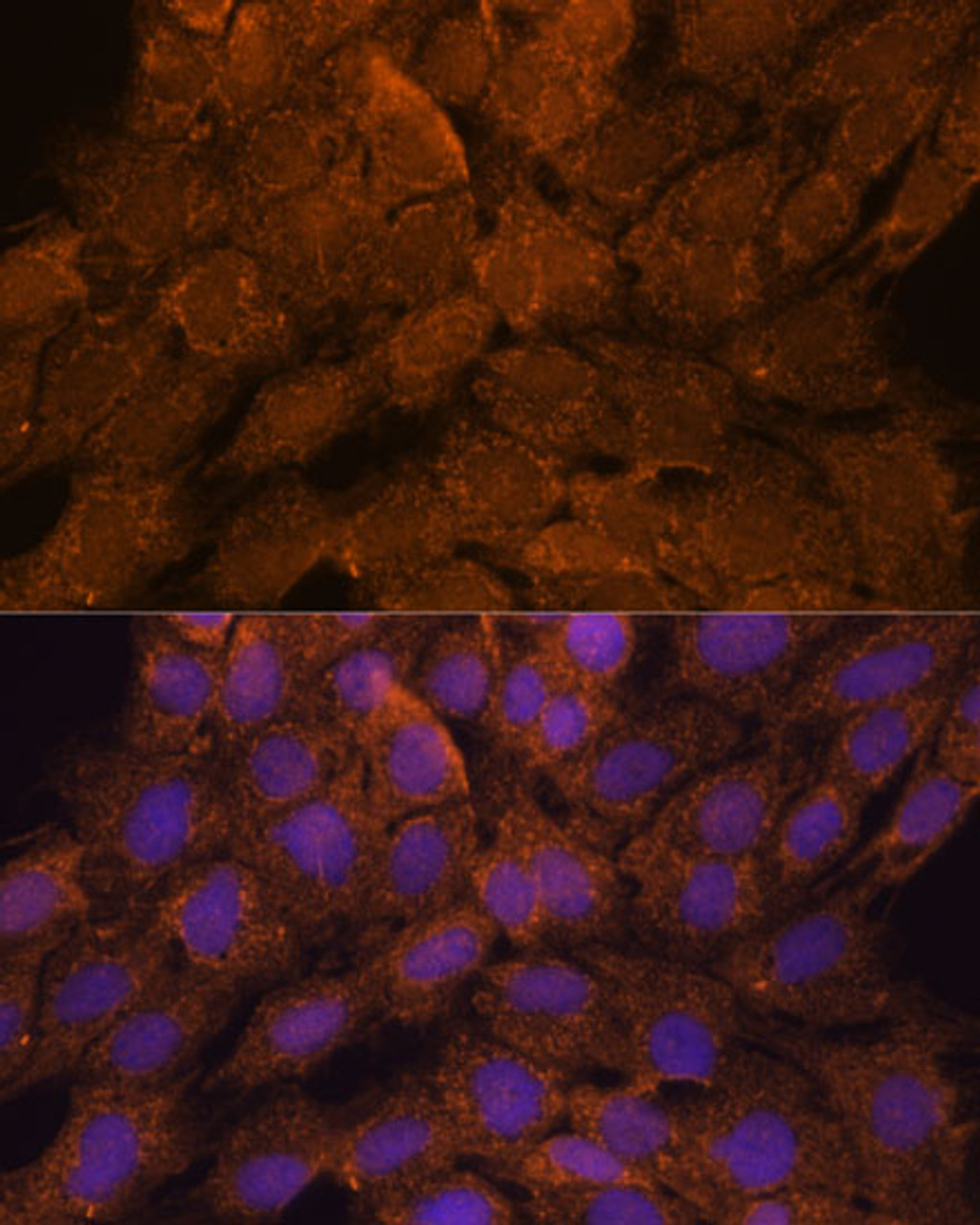 Immunofluorescence analysis of C6 cells using TNFAIP8L2 Polyclonal Antibody at dilution of  1:100. Blue: DAPI for nuclear staining.