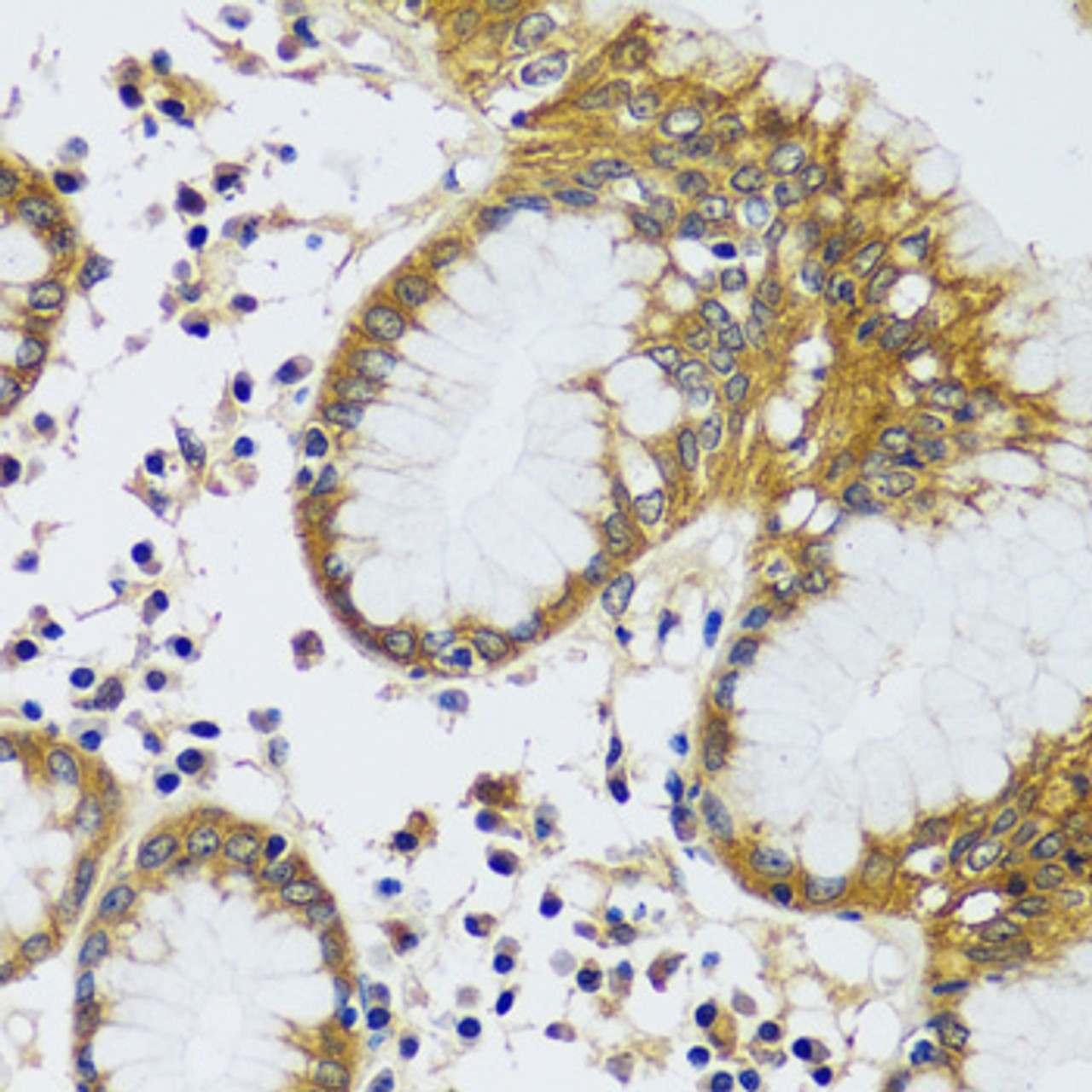 Immunohistochemistry of paraffin-embedded Human stomach using CAMLG Polyclonal Antibody at dilution of  1:100 (40x lens).