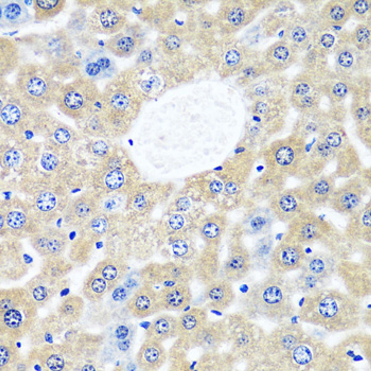 Immunohistochemistry of paraffin-embedded Mouse liver using CAMLG Polyclonal Antibody at dilution of  1:100 (40x lens).