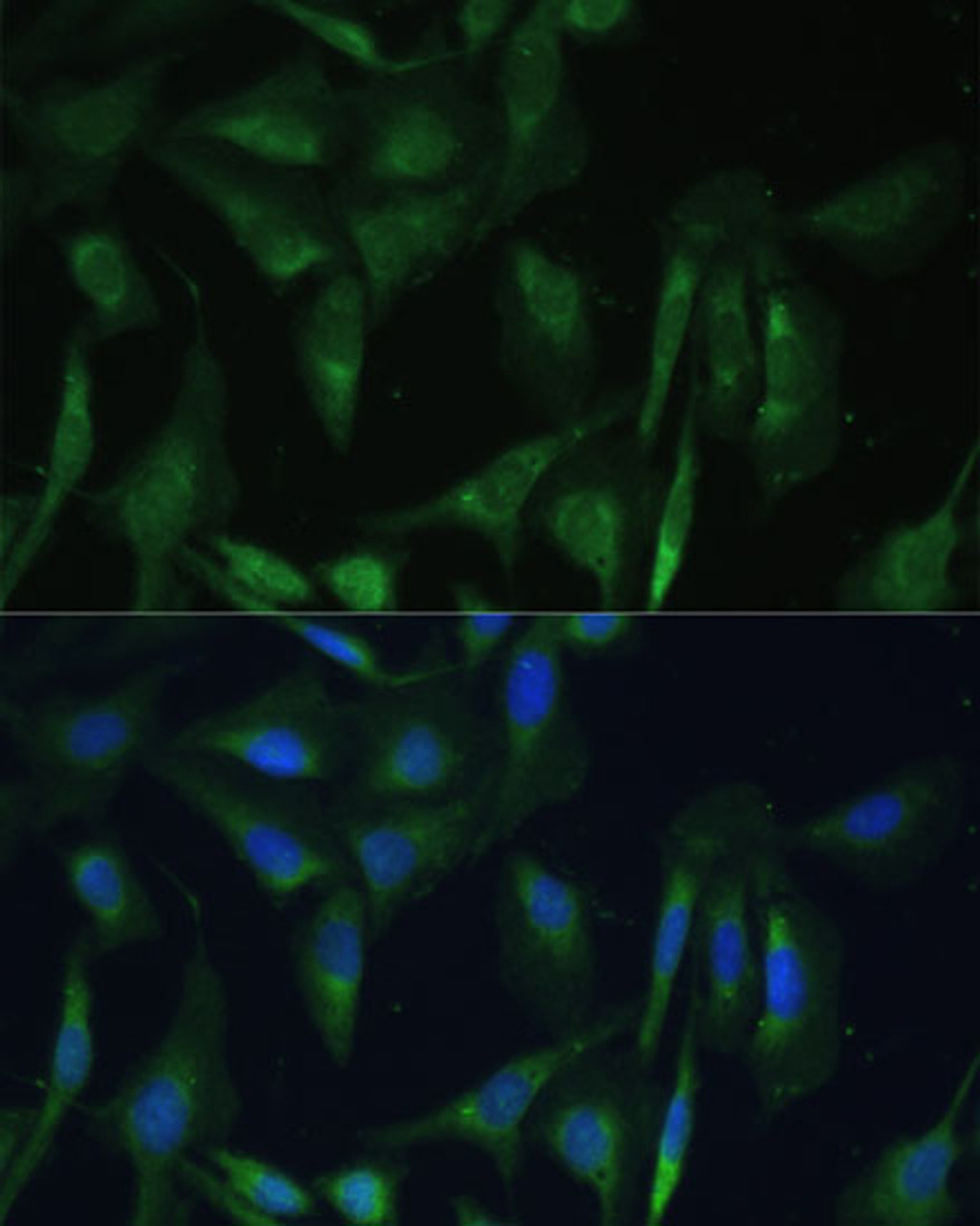 Immunofluorescence analysis of U-2 OS cells using CAMLG Polyclonal Antibody at dilution of  1:100 (40x lens). Blue: DAPI for nuclear staining.