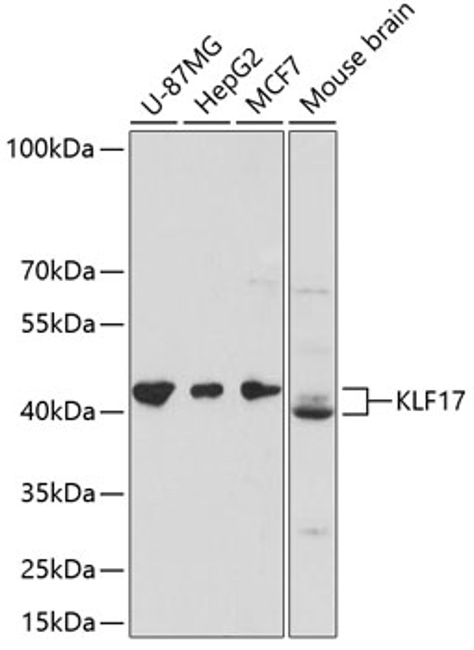 Western blot analysis of extracts of various cell lines using KLF17 Polyclonal Antibody at dilution of 1:3000.