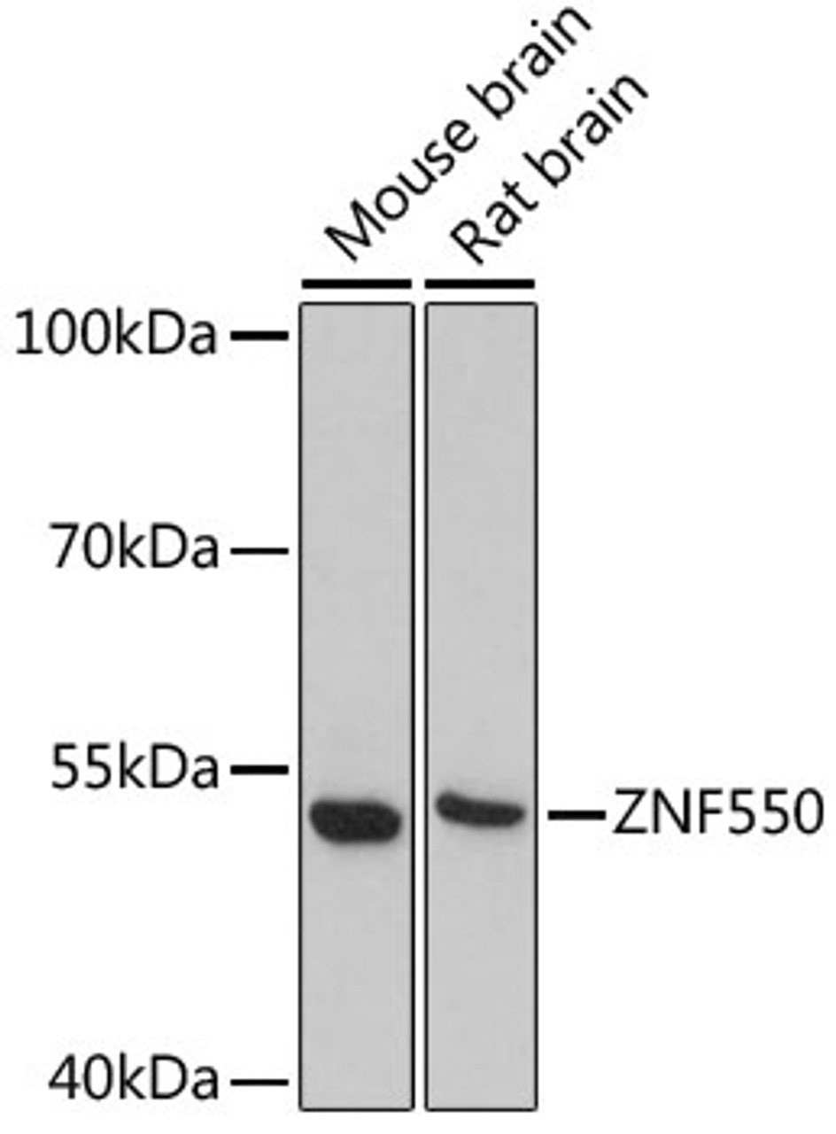 Western blot analysis of extracts of various cell lines using ZNF550 Polyclonal Antibody at dilution of 1:3000.