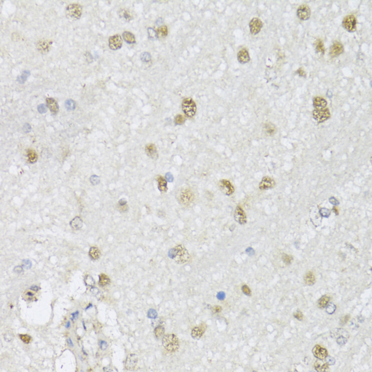 Immunohistochemistry of paraffin-embedded Mouse brain using CMAS Polyclonal Antibody at dilution of  1:150 (40x lens).