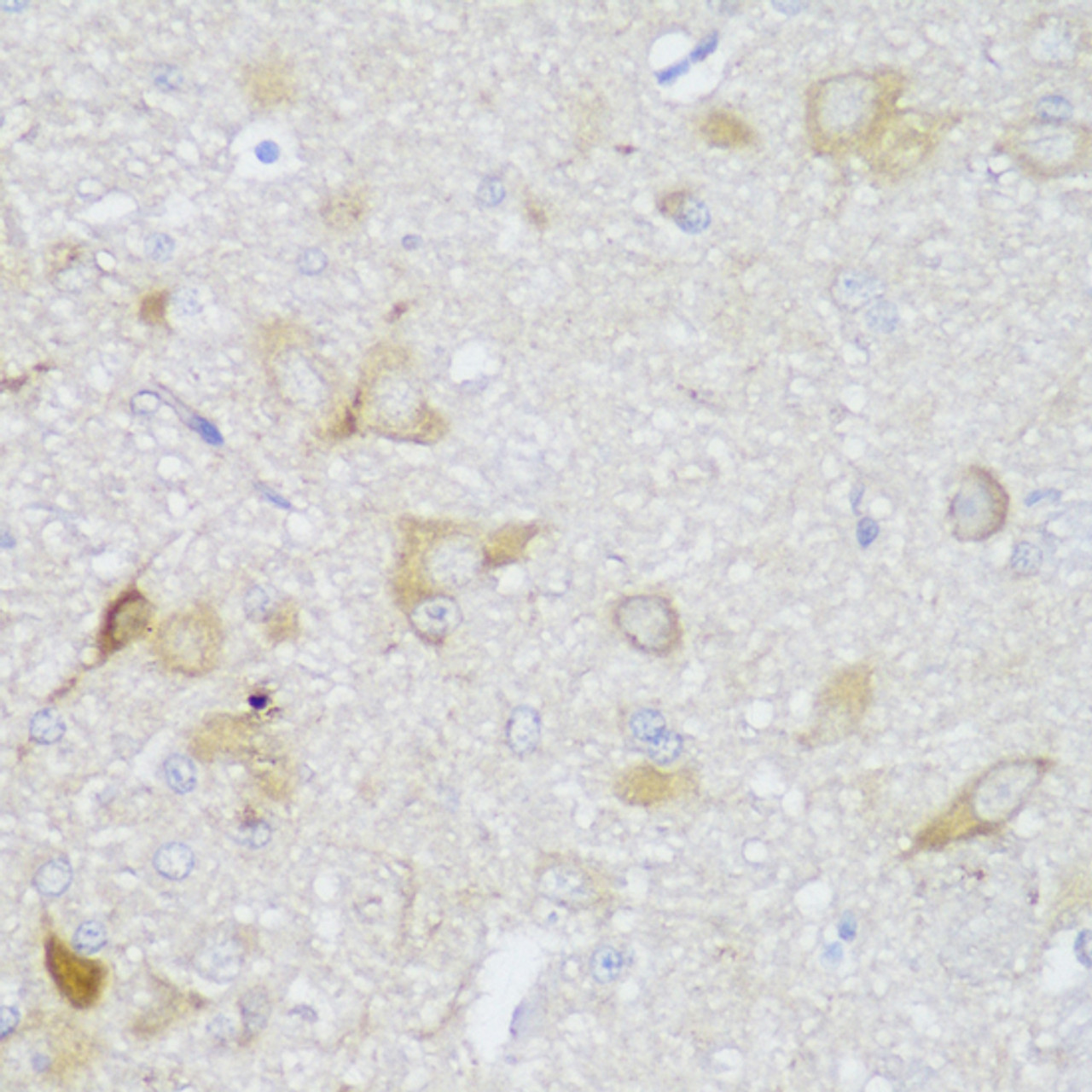 Immunohistochemistry of paraffin-embedded Rat brain using EDC3 Polyclonal Antibody at dilution of  1:150 (40x lens).