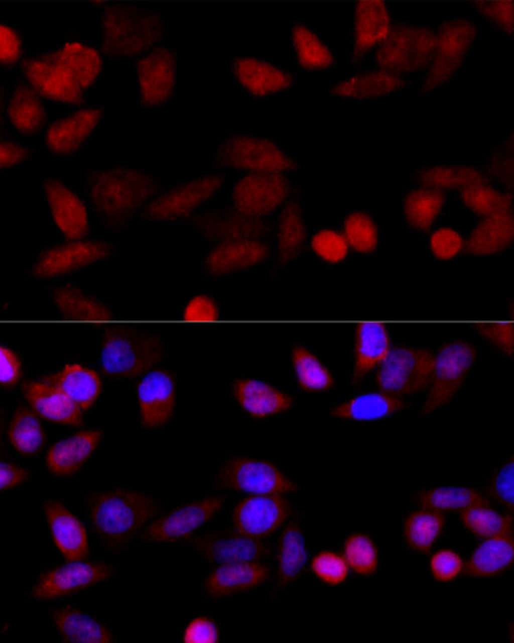 Immunofluorescence analysis of HeLa cells using CYP1B1 Polyclonal Antibody at dilution of  1:100 (40x lens). Blue: DAPI for nuclear staining.