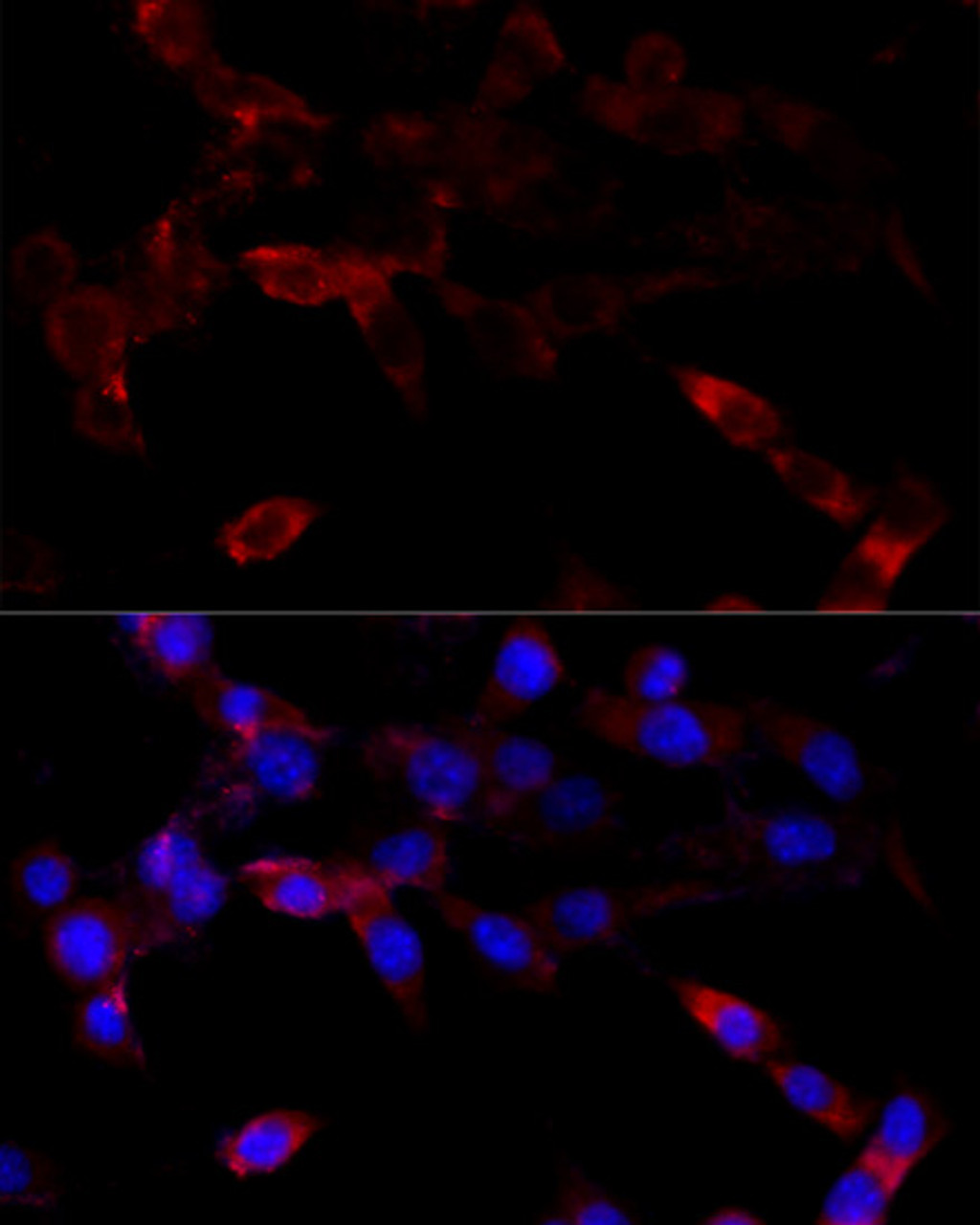Immunofluorescence analysis of NIH/3T3 cells using CYP1B1 Polyclonal Antibody at dilution of  1:100 (40x lens). Blue: DAPI for nuclear staining.