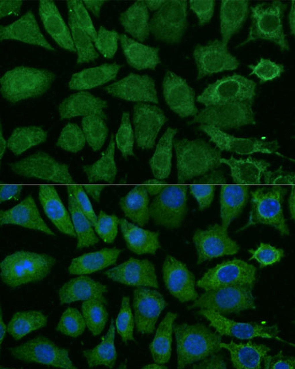 Immunofluorescence analysis of L929 cells using NDUFB4 Polyclonal Antibody at dilution of  1:100 (40x lens). Blue: DAPI for nuclear staining.