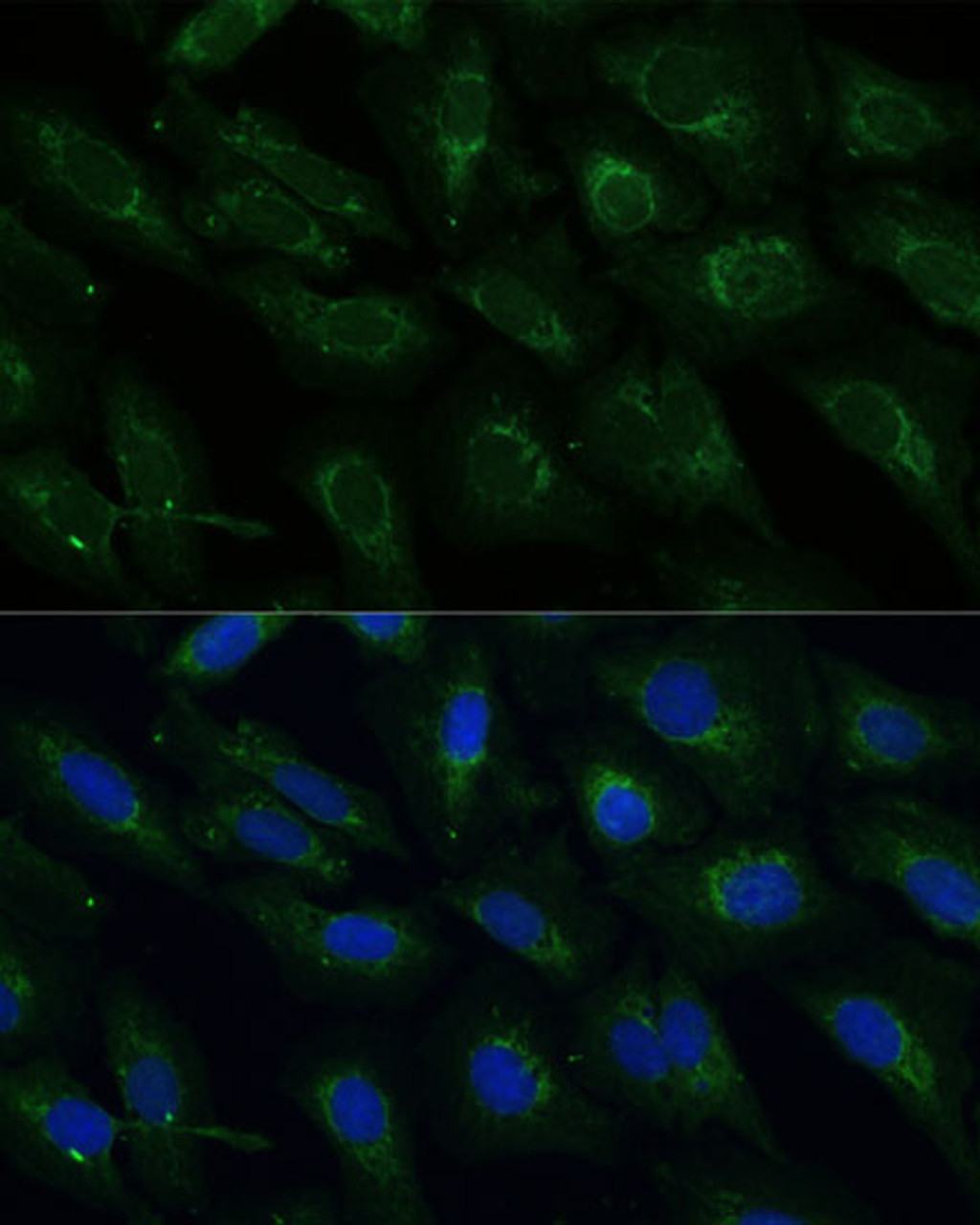 Immunofluorescence analysis of U-2 OS cells using NDUFB4 Polyclonal Antibody at dilution of  1:100 (40x lens). Blue: DAPI for nuclear staining.