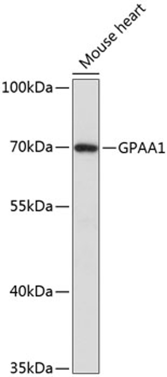 Western blot analysis of extracts of Mouse heart using GPAA1 Polyclonal Antibody at dilution of 1:3000.