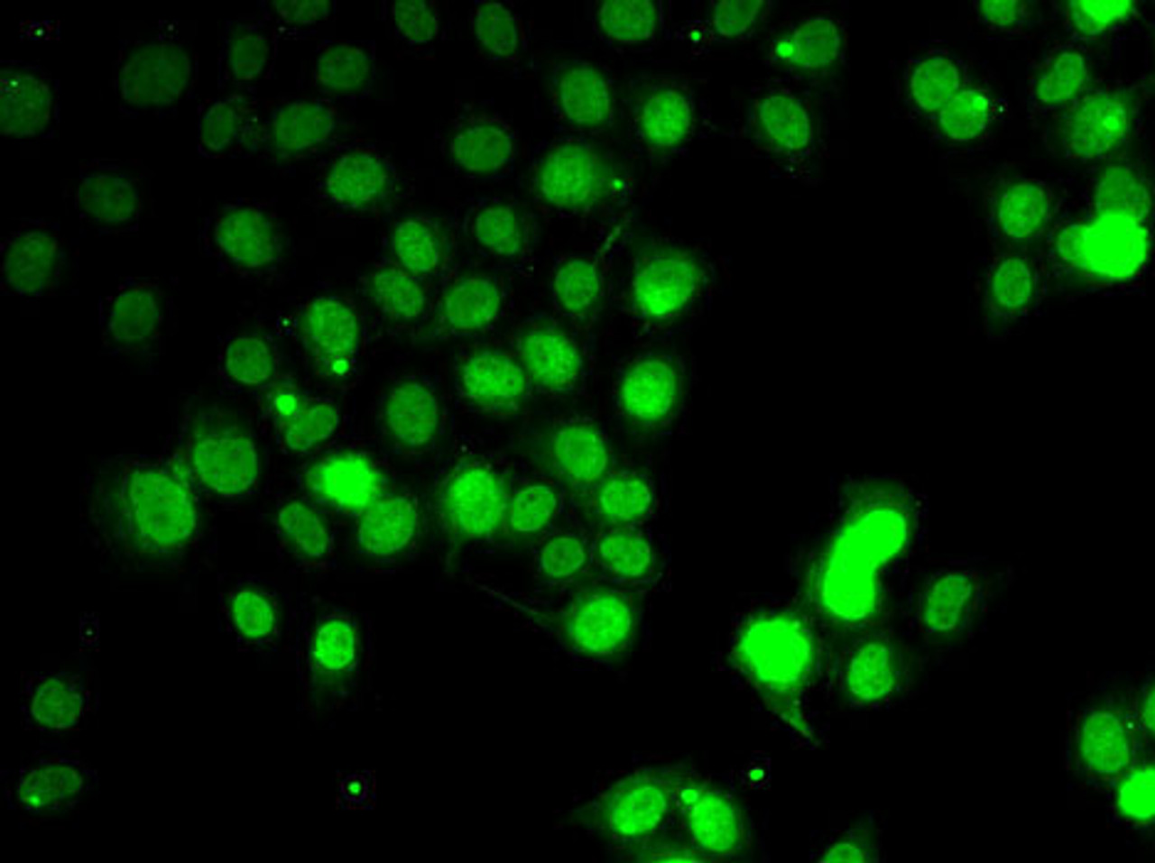 Immunofluorescence analysis of HeLa cells using GABARAP Polyclonal Antibody