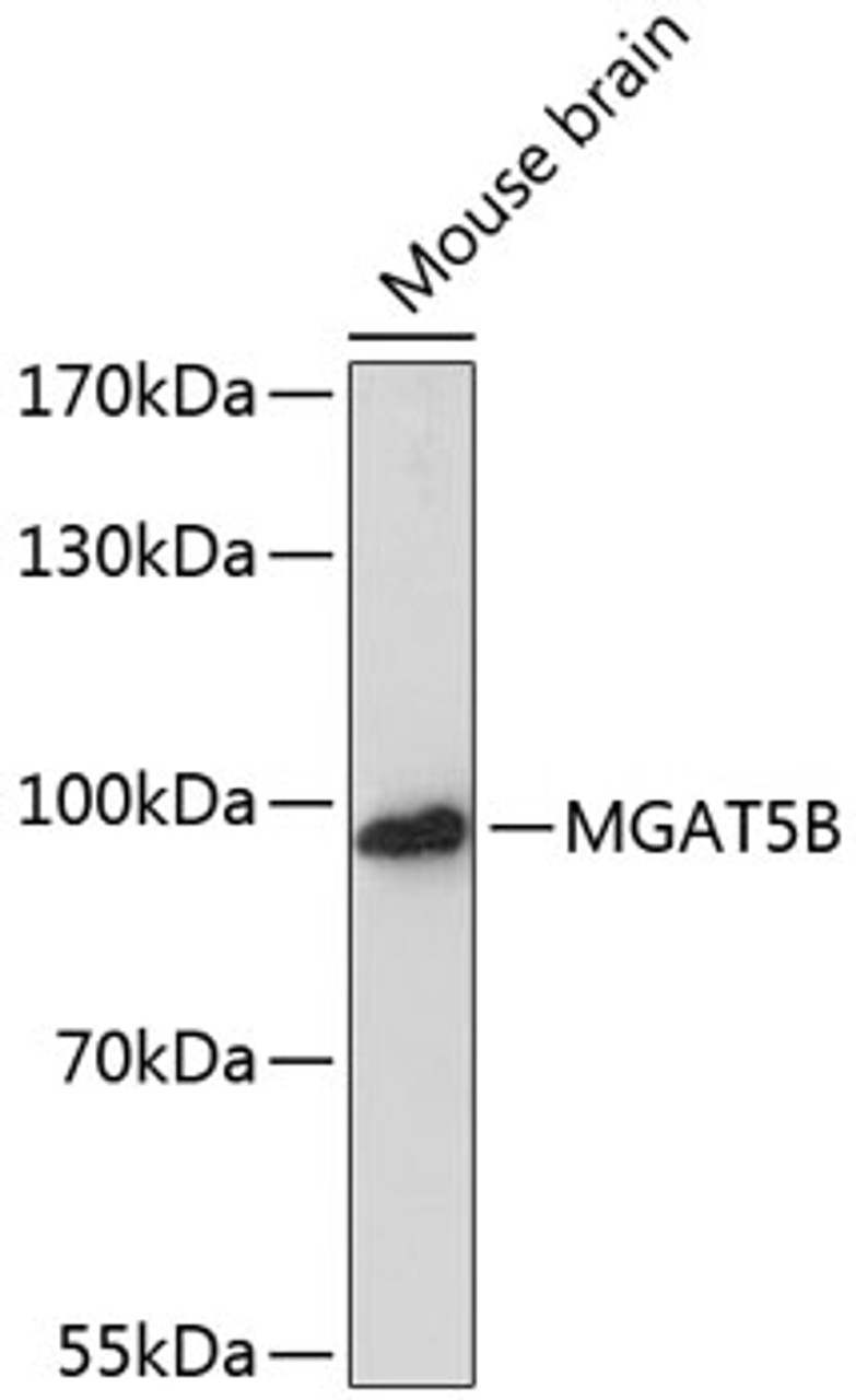 Western blot analysis of extracts of Mouse brain using MGAT5B Polyclonal Antibody at dilution of 1:3000.