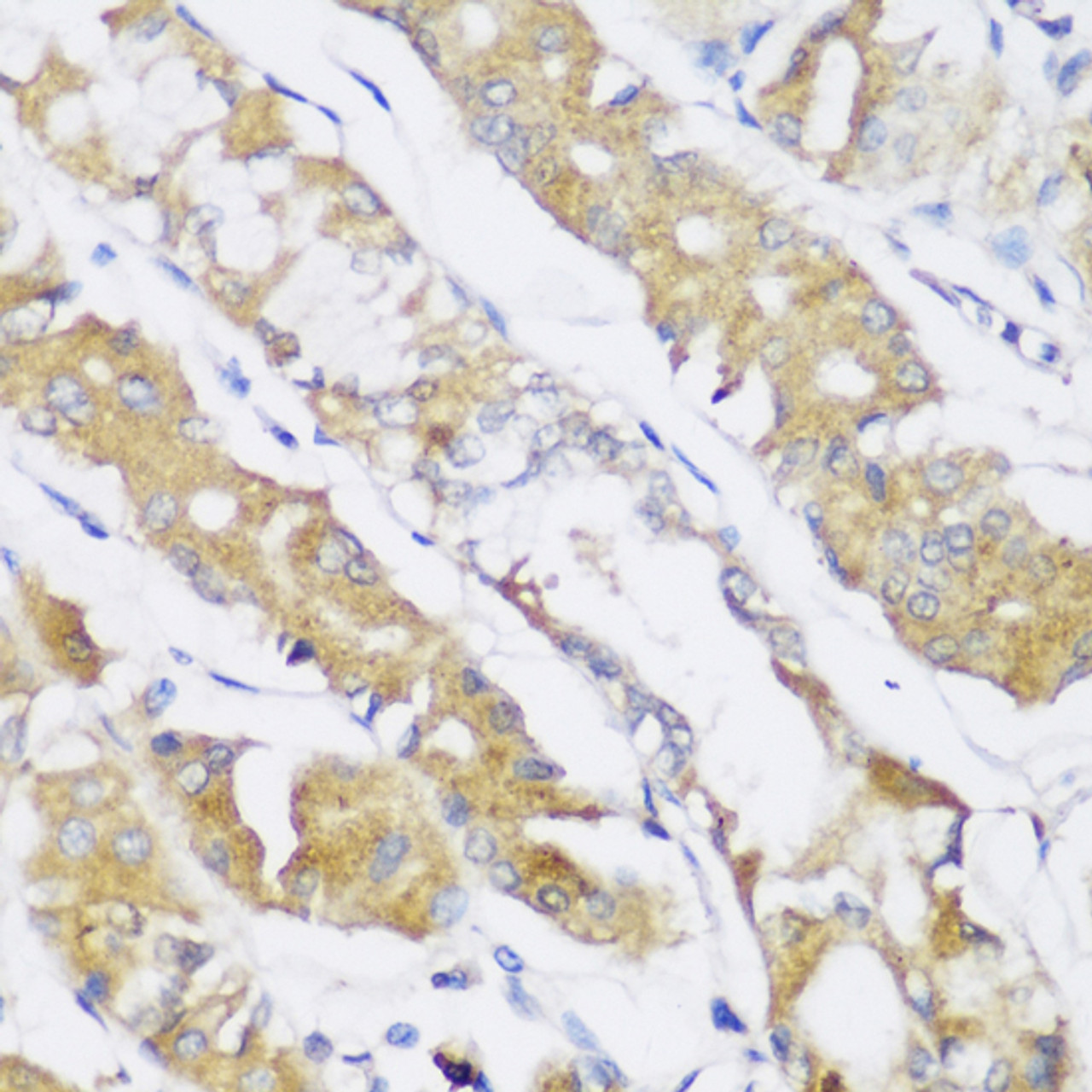 Immunohistochemistry of paraffin-embedded Human stomach using FA2H Polyclonal Antibody at dilution of  1:150 (40x lens).