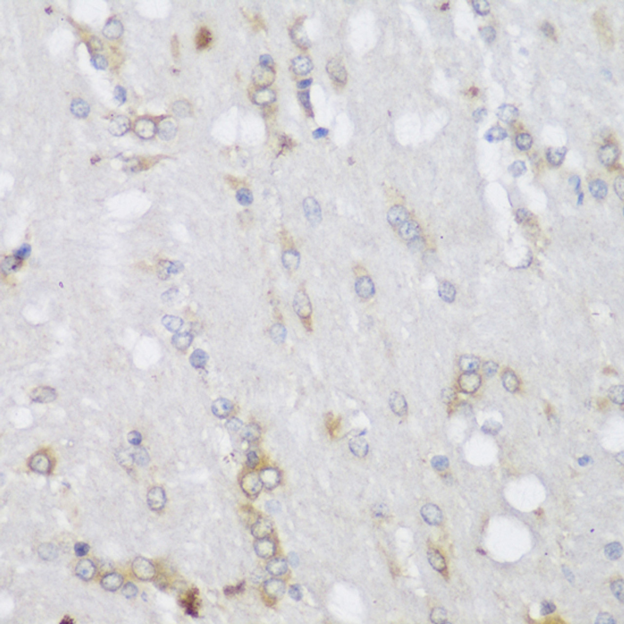 Immunohistochemistry of paraffin-embedded Rat brain using FA2H Polyclonal Antibody at dilution of  1:150 (40x lens).