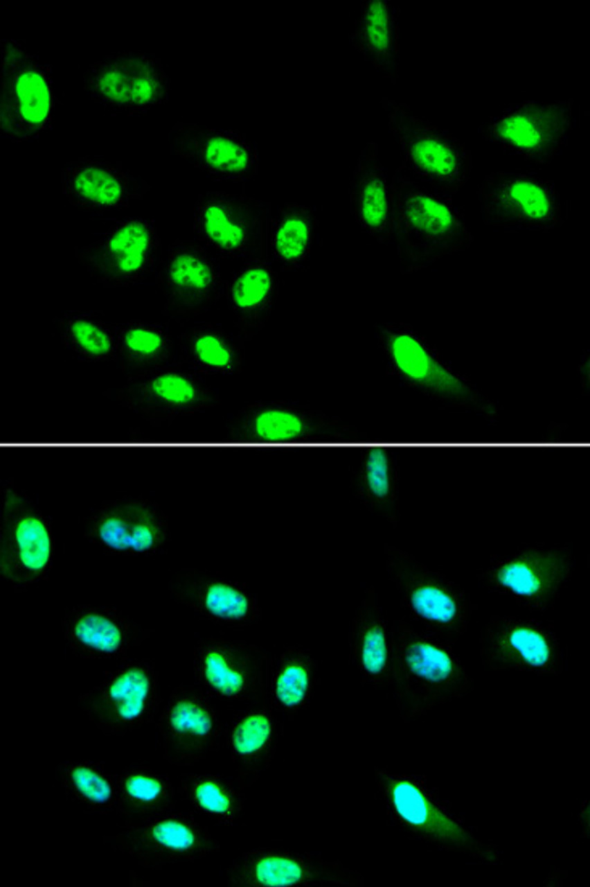 Immunofluorescence analysis of HepG2 cells using FCGR2A Polyclonal Antibody