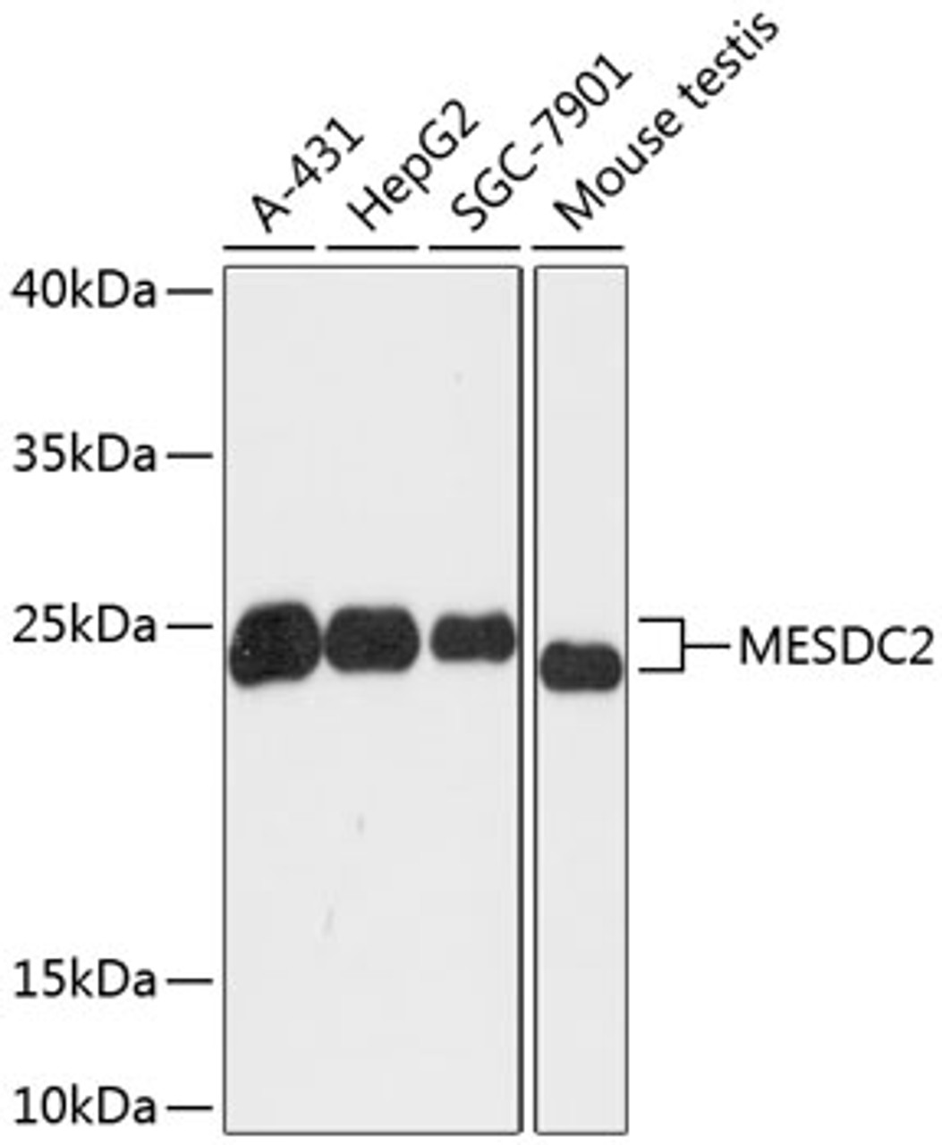 Western blot analysis of extracts of various cell lines using MESDC2 Polyclonal Antibody at dilution of 1:3000.