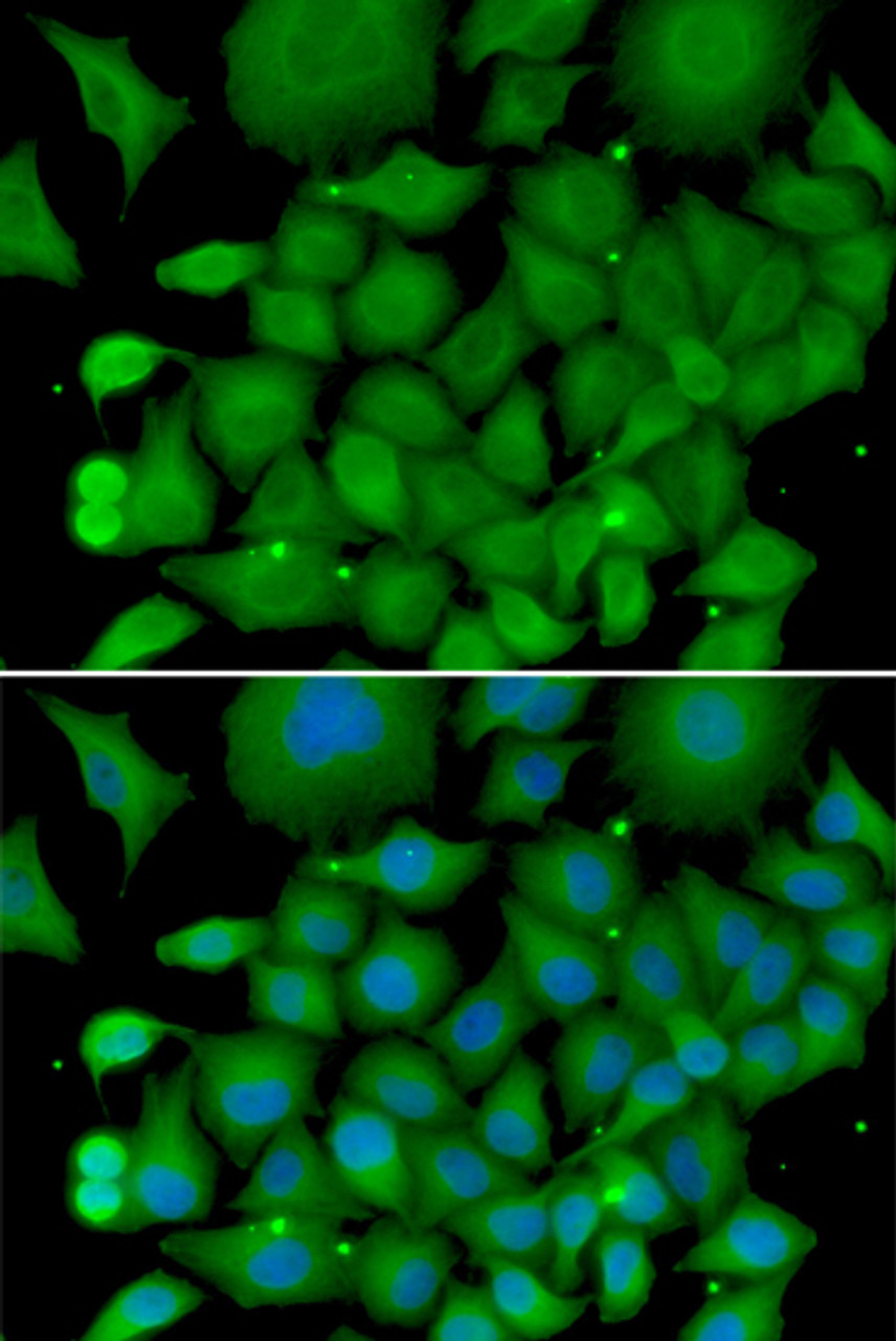 Immunofluorescence analysis of U2OS cells using SOD3 Polyclonal Antibody