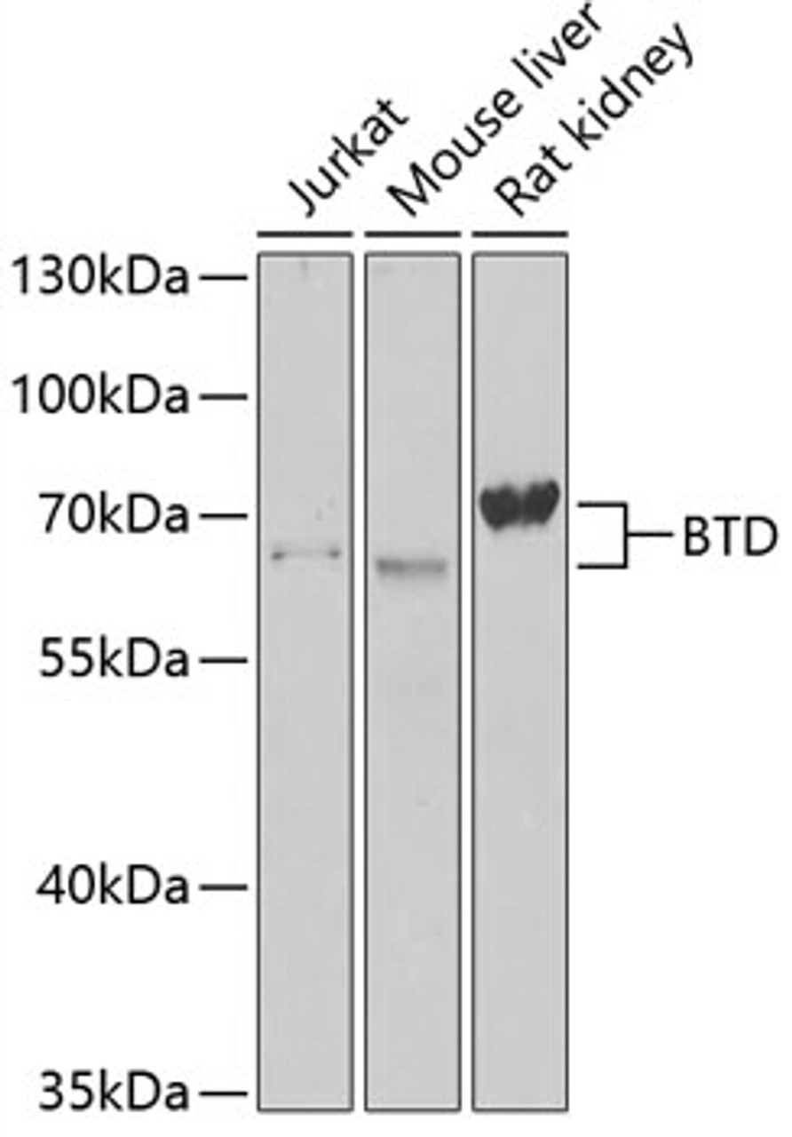 Western blot analysis of extracts of various cell lines using BTD Polyclonal Antibody at dilution of 1:1000.