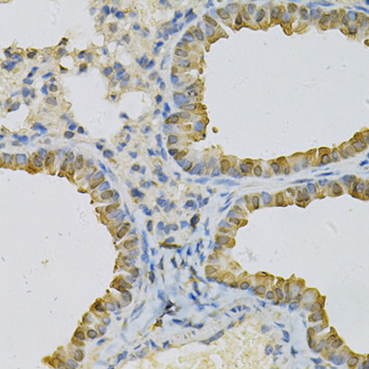 Immunohistochemistry of paraffin-embedded Mouse lung using CDA Polyclonal Antibody at dilution of  1:100 (40x lens).