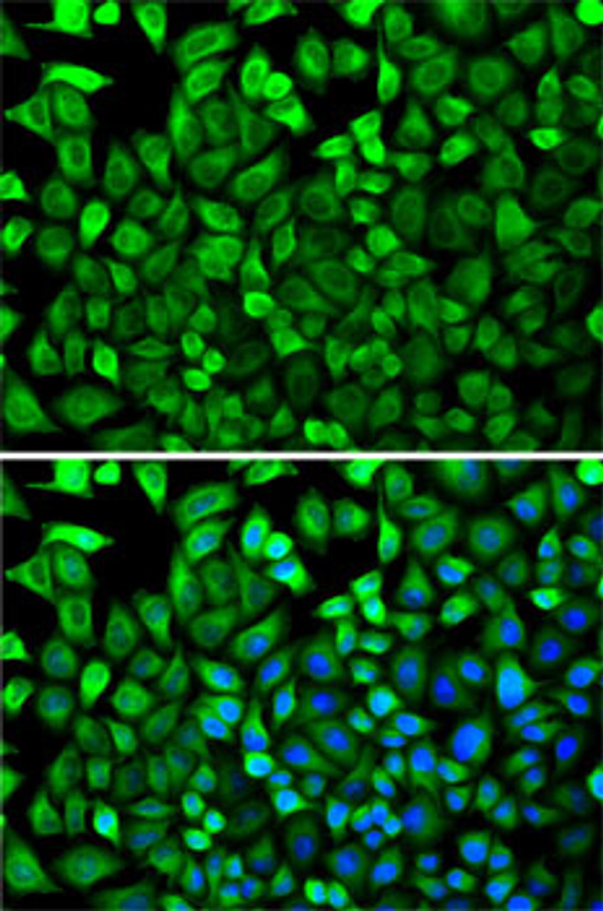 Immunofluorescence analysis of HeLa cells using CDA Polyclonal Antibody