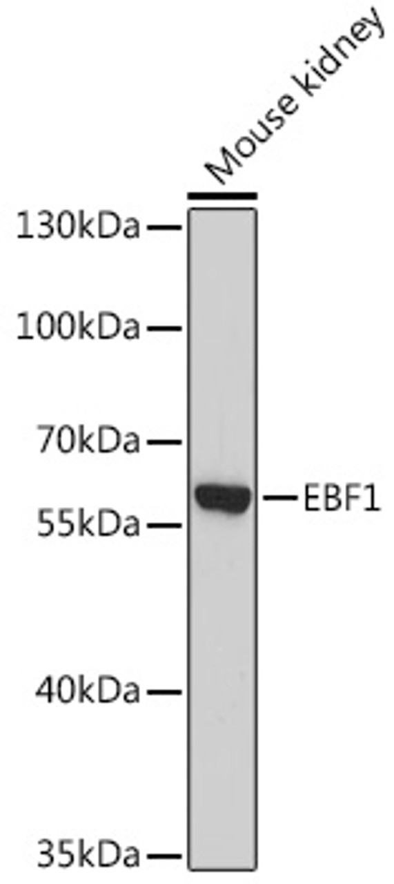 Western blot analysis of extracts of Mouse kidney using EBF1 Polyclonal Antibody at dilution of 1:1000.