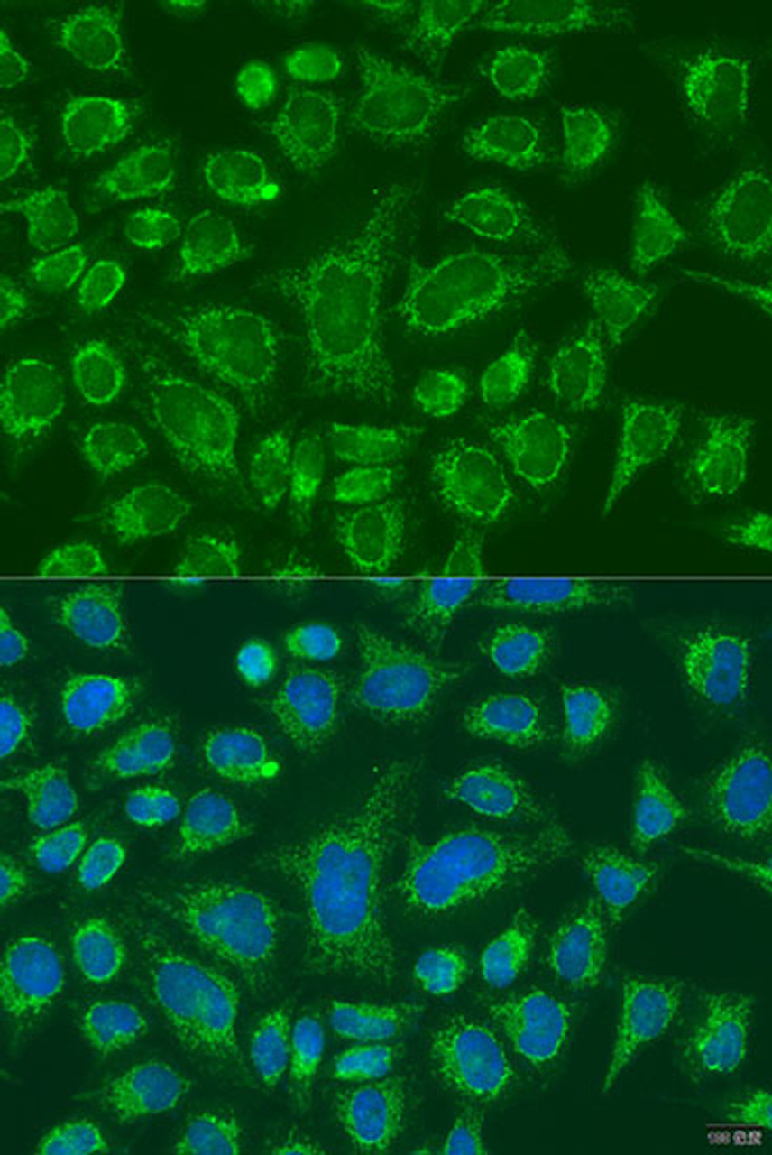 Immunofluorescence analysis of U2OS cells using FCGR3B Polyclonal Antibody at dilution of  1:100. Blue: DAPI for nuclear staining.