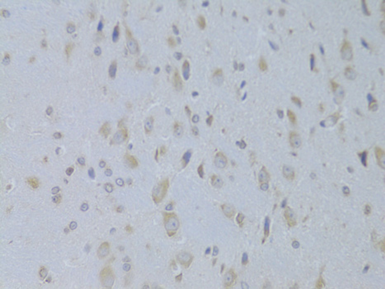 Immunohistochemistry of paraffin-embedded Rat brain using IGF2 Polyclonal Antibody at dilution of  1:100 (40x lens).