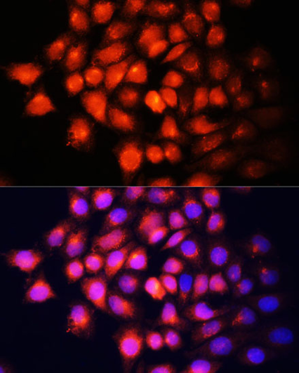 Immunofluorescence analysis of HeLa cells using IGF2 Polyclonal Antibody at dilution of  1:100 (40x lens). Blue: DAPI for nuclear staining.