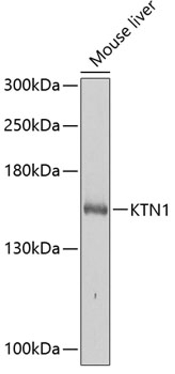 Western blot analysis of extracts of Mouse liver using KTN1 Polyclonal Antibody at dilution of 1:1000.