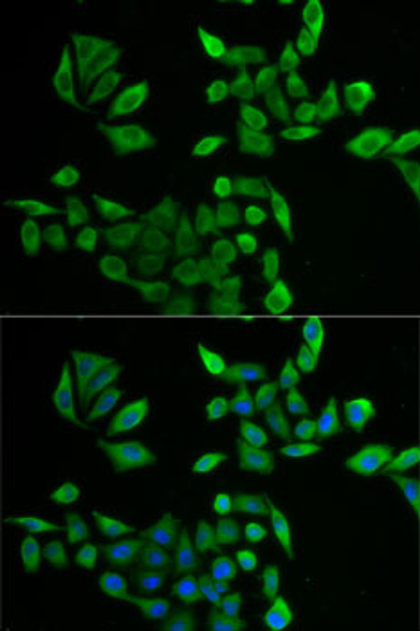 Immunofluorescence analysis of U2OS cells using PNP Polyclonal Antibody